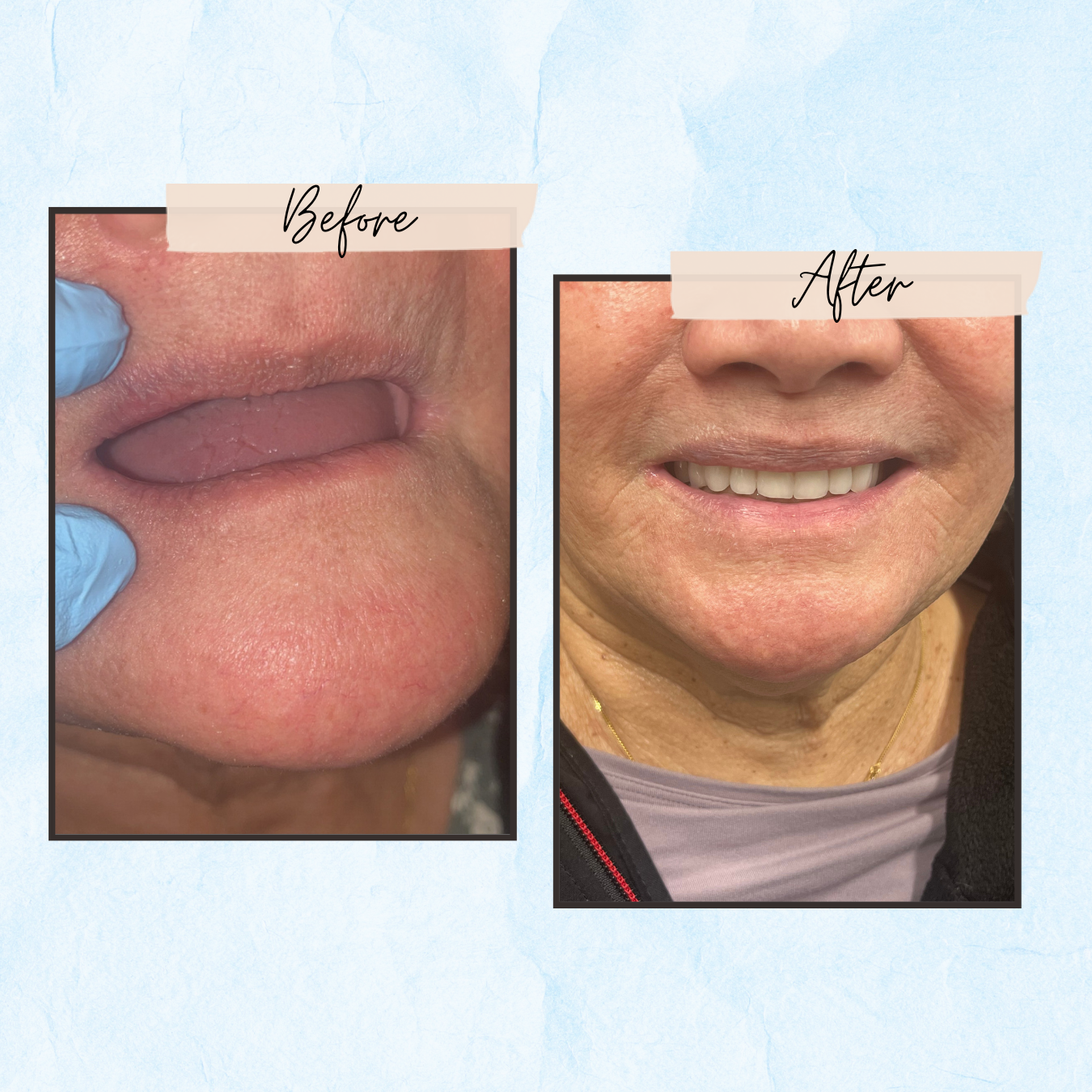 A before and after picture of a woman 's face