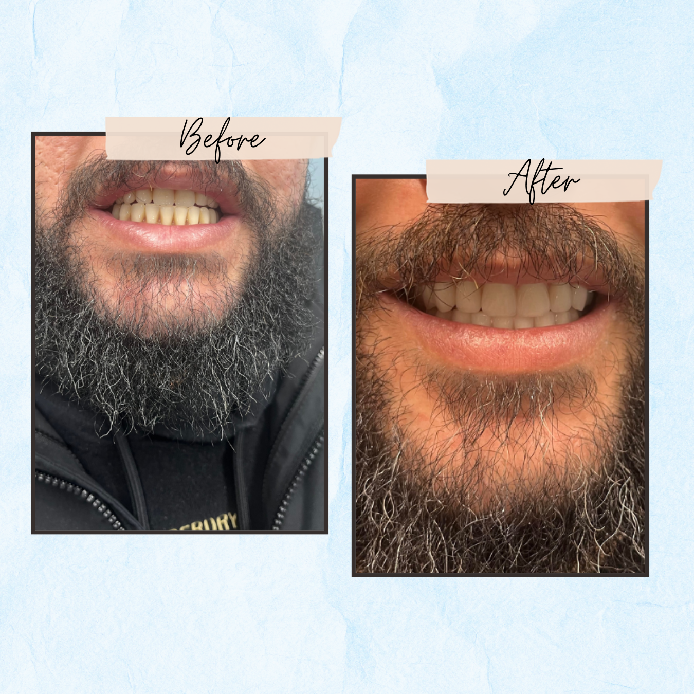 A before and after photo of a man with a beard