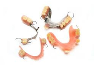 Elevating Smiles: The Pinnacle of Comfort and Stability with Implant-Supported Dentures