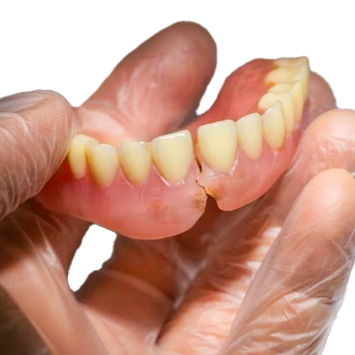 Denture Repairs