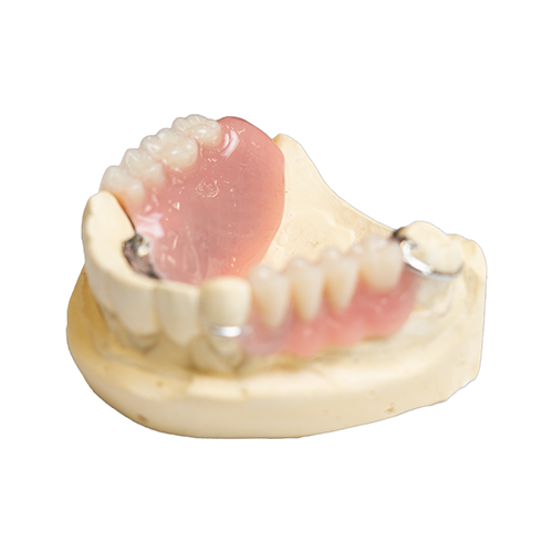 Partial Denture