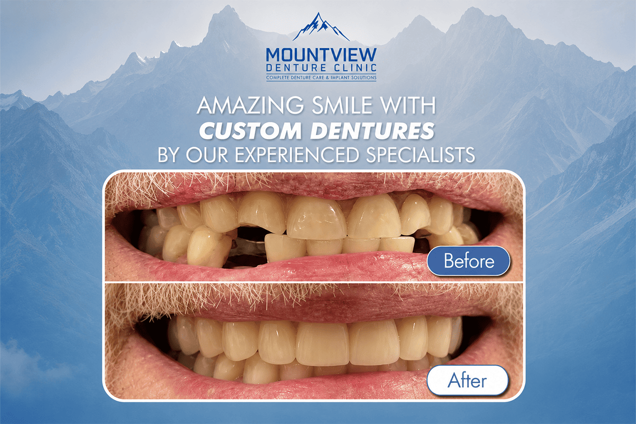 Before and After Dentures