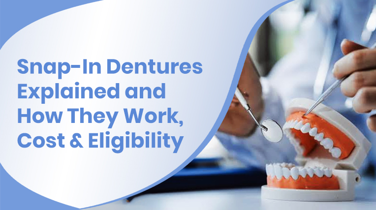 snap-in dentures explained